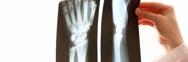 Fokussiertes Foto auf Röntgenbild, das das Handgelenk zeigt — Stockfoto