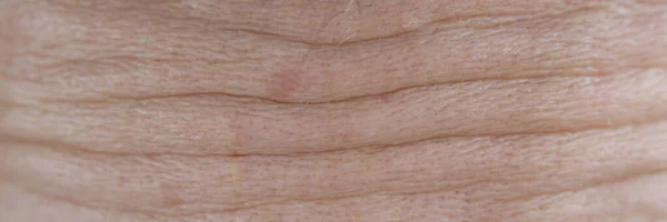 Facial wrinkles on forehead of adult woman closeup — Stock Photo, Image