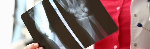 Médecin vérifiant un film radiographique de la main dans un hôpital — Photo