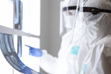 Koruyucu giysili doktorlar klinikteki röntgenlere bakıyorlar.