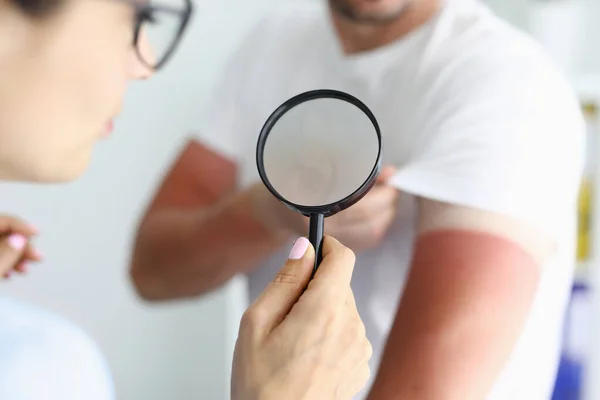 Dokter onderzoekt zonnebrand op de arm van de patiënt met vergrootglas close-up — Stockfoto