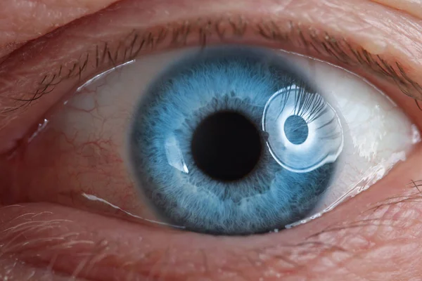 El ojo humano es azul. Examen del órgano de visión en adultos — Foto de Stock