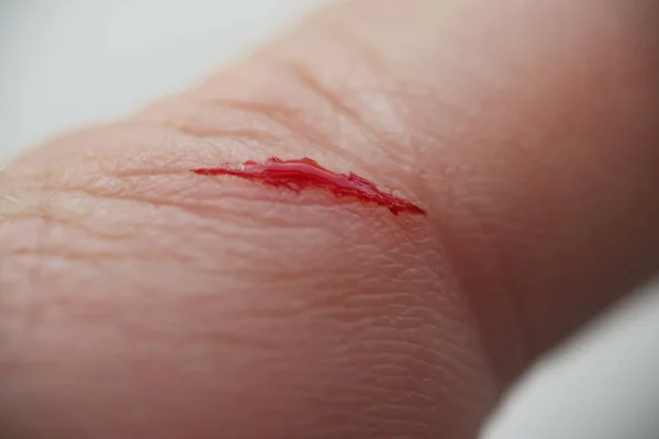 Hand of adult man with wound and blood — Stock Photo, Image