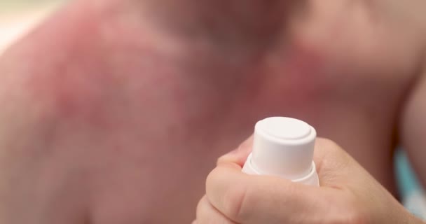 Az ember kinyitja a napvédő spray-t, hogy megvédje a bőrét a Sun 4k filmtől — Stock videók