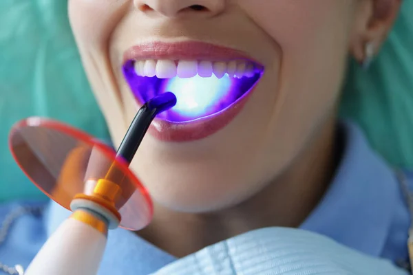 Οδοντίατρος γεμίζει τα δόντια των ασθενών με τη θεραπεία φως closeup — Φωτογραφία Αρχείου