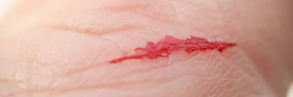 Primo piano di graffio con sangue sulla mano dell'uomo — Foto Stock