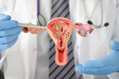 Doktorun rahmin mankeni ve yumurtalıkları üniversiteyi kapatıyor.