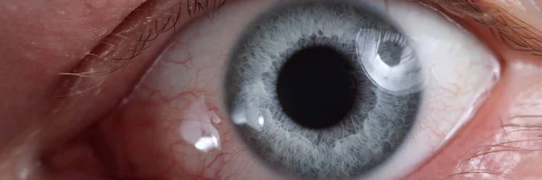 Крупный план больного глаза с красными расширенными сосудами — стоковое фото