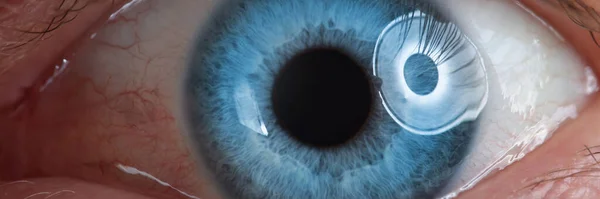 Ludzkie oko jest niebieskie. Badanie narządu wzroku u dorosłych — Zdjęcie stockowe