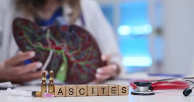 Tahta bloklar karaciğer modeline ve ampullere karşı Ascites kelimesini heceliyor. Hepatoloji doktoru labaratuvarda vaka planlama sıvısı boşaltma prosedürünü inceledi