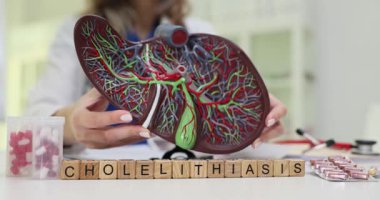 Tahta bloklar safra kesesi modeliyle karaciğerin yakınındaki kolelithiasis kelimesini heceler. Kadın doktor kolelithiasis için anatomik model planlama tedavisi gösteriyor.