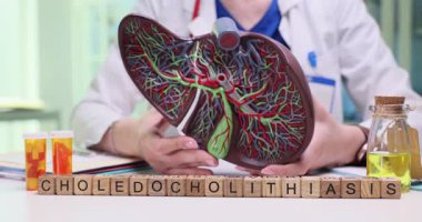 Kadın doktor karaciğerin detaylı anatomik modelini elinde tutuyor. Masada düzgün sıralanmış minyatür ahşap küpler tıbbi terimle Choledocholithiasis.