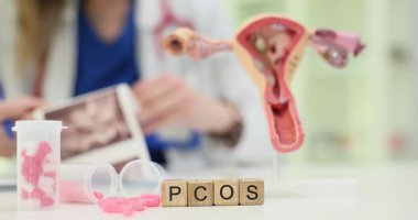 Kadın doktor ultrason taraması yaparken jinekoloji masasındaki tahta bloklar PCOS kelimesini heceliyor. İlaçlı rahim modeli hormon bozukluğunu simgeler.