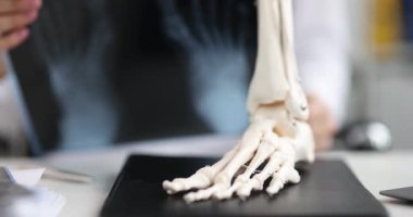Ortopedik doktor ayak röntgenini ayak bileği iskeleti modelinin arkasında tutuyor. Uzman, hasta için görüntü planlama tedavisinde ayak kemikleri sıralaması üzerinde çalışıyor