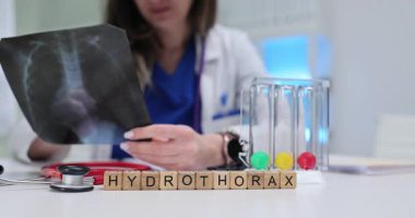 Tahta bloklardan ve nefes egzersizlerinden oluşan Hydrothorax kelimesi doktor masasında. Kadın terapist hastanedeki hastanın akciğer röntgenlerini analiz ediyor.