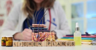 Tahta küpler deri modelinin yanındaki Lichen Planus kelimelerini heceler. Kadın dermatolog laboratuardaki kronik yanma sırasında kızarıklık terapisi değerlendirmesi için kayıt tutuyor.