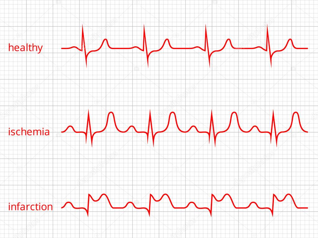 Healthy Heart Beat Chart