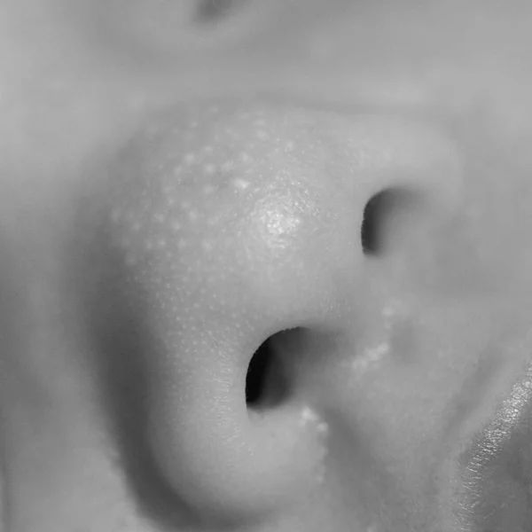 Detail Nosu Novorozence Malými Cysty Černé Bílé — Stock fotografie