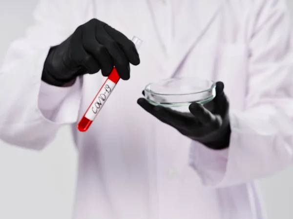 male laboratory assistant white coat black gloves test tube with blood