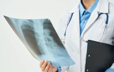 Göğüs röntgeni ve doktor önlüğü.