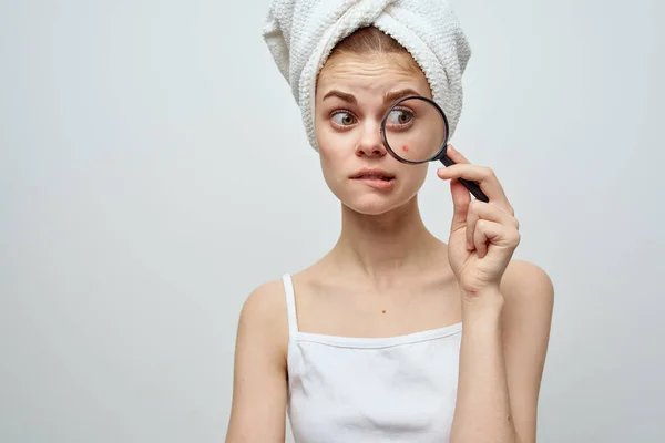 Mulher com lupa na mão e acne no rosto com uma toalha na cabeça acne — Fotografia de Stock