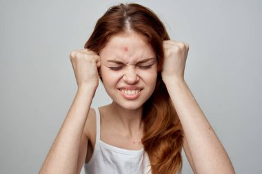 Yüzünde sivilce olan beyaz tişörtlü güzel bir kadın.