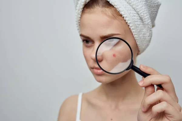 Mujer con una toalla en la cabeza magnifica los problemas de la piel del grano a través de una lupa — Foto de Stock