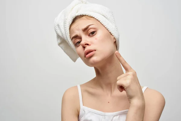 Жінка з рушником на голові на світлому фоні і прищами на обличчі перехідного віку чиста модель шкіри — стокове фото