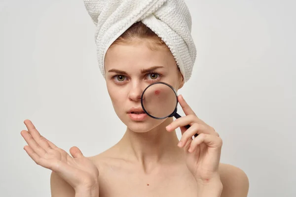 Vrouw met acne op haar gezicht houdt een vergrootglas en boos blik handdoek op haar hoofd — Stockfoto