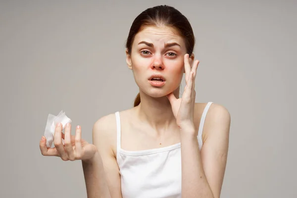 Wanita dengan saputangan hidung berair masalah kesehatan virus ketidakpuasan — Stok Foto