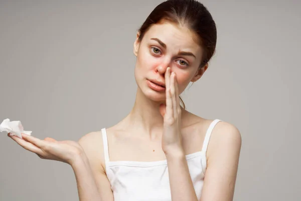 Sjuk kvinna näsduk rinnande näsa infektion sjukdomskänsla — Stockfoto