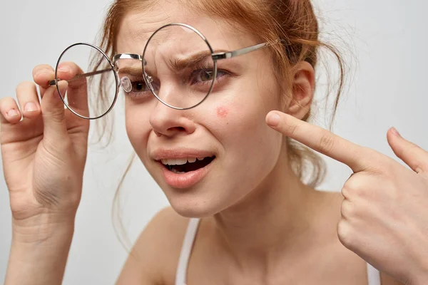 Mujer en gafas muestra un dedo a una espinilla roja en su cara — Foto de Stock