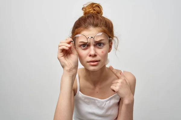 Egy szemüveges nő egy piros pattanást mutat az arcán. — Stock Fotó