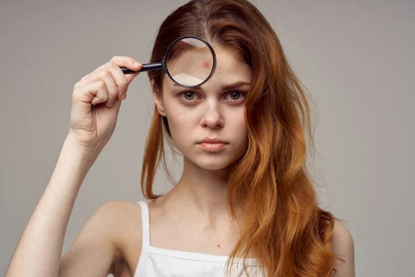 Mulher com lupa perto do rosto acne janela problemas de saúde dermatologia e cosmetologia — Fotografia de Stock