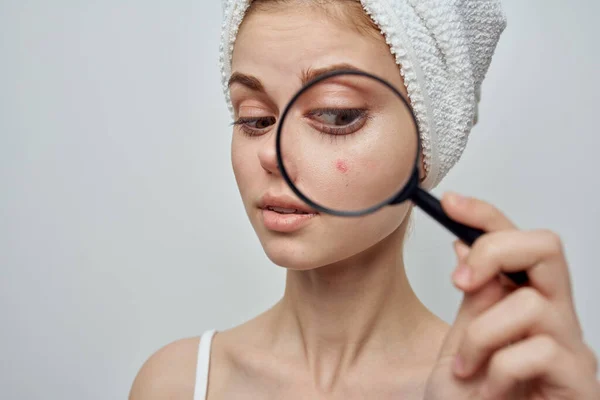Mulher com uma toalha na cabeça amplia problemas de pele de espinha através de uma lupa — Fotografia de Stock
