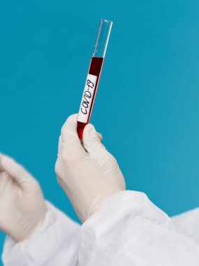 Kan testi tanı laboratuvarı covid-19 tedavi mavi arka plan