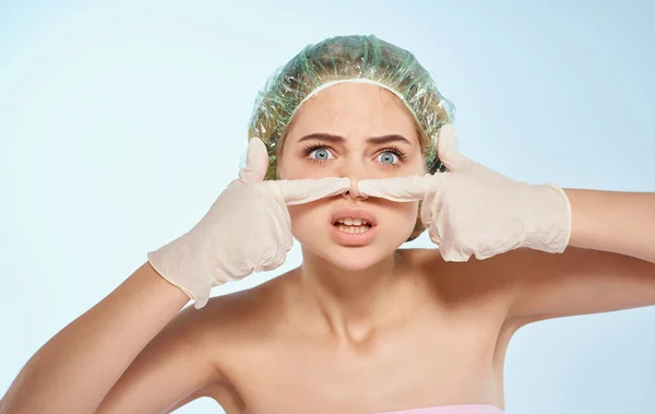 Woman in a cap acne on the face and cosmetology dermatology skin care — Stock Photo, Image