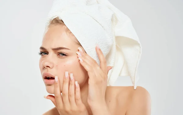 Una mujer con una toalla en la cabeza exprime el acné en su cara problema piel cosmetología dermatología — Foto de Stock