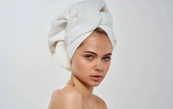 Glad kvinde med håndklæde på hovedet ren hud kosmetologi nøgne skuldre - Stock-foto