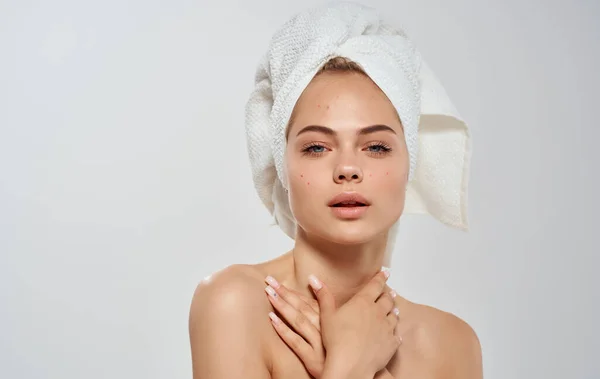 Félmeztelen nő kiegyenesíti a törülközőt a fején tiszta bőr haj modell — Stock Fotó
