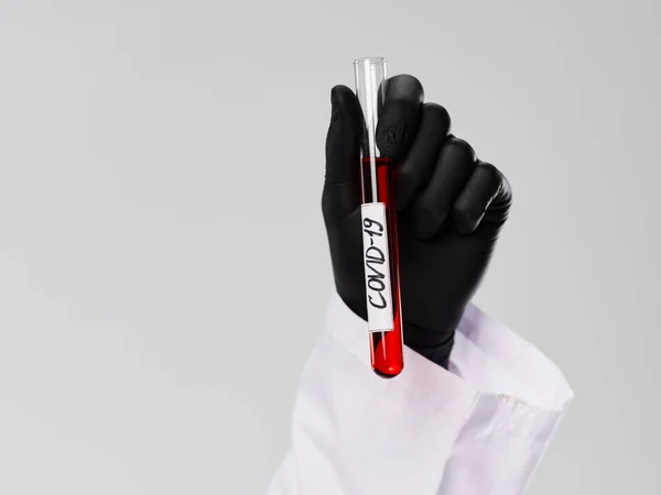 Badanie krwi w rękach technika laboratoryjnego czarna rękawica badania diagnostyka — Zdjęcie stockowe