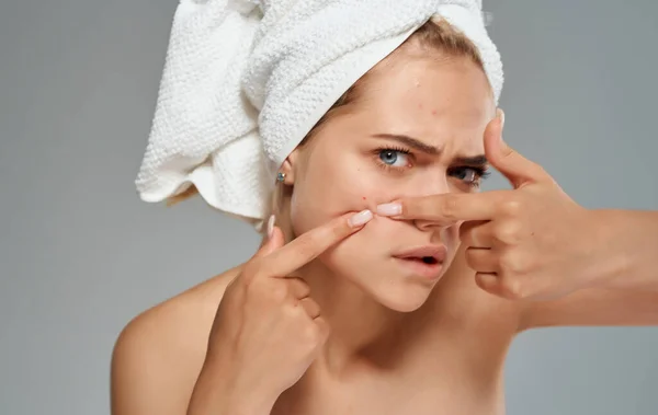 Mujer emocional con una toalla en la cabeza exprime espinillas en la cara sobre un fondo gris — Foto de Stock