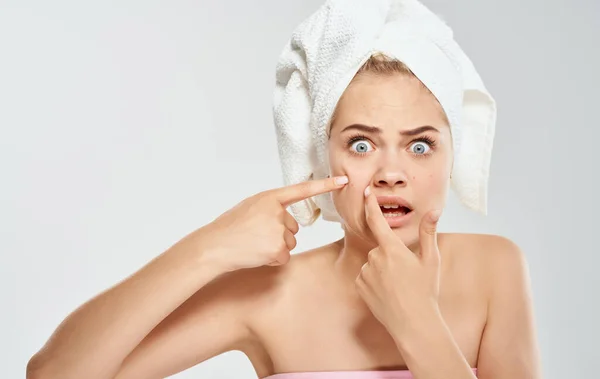 Femme agacée presse des boutons sur son visage et une serviette sur sa tête fond gris cosmétologie dermatologie — Photo