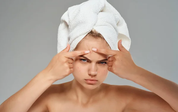 Emocional mujer exprime espinillas en la frente y toalla en la cabeza hombros desnudos vista recortada — Foto de Stock