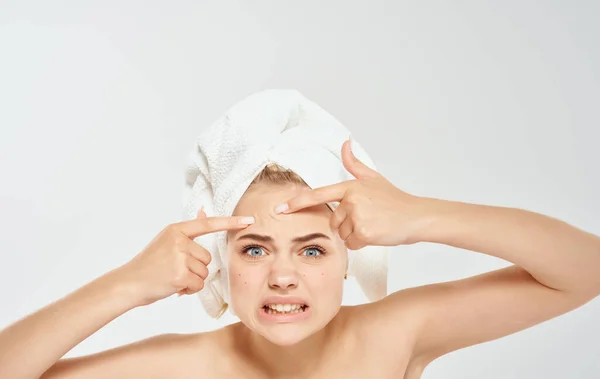 Irriterad kvinna klämmer ut finnar i ansiktet och en handduk på huvudet grå bakgrund kosmetologi dermatologi — Stockfoto