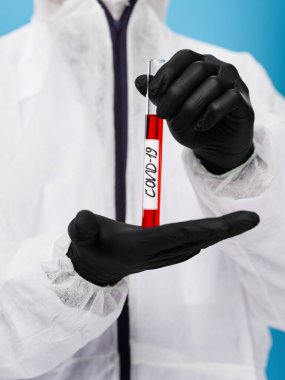 Kan testi tutan laboratuvar siyah koruyucu eldivenler covid-19 