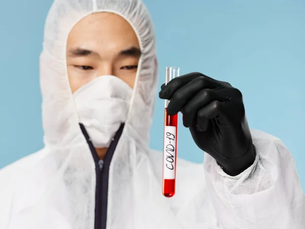 Чоловік тримає плазму крові в руках, аналіз досліджень — стокове фото