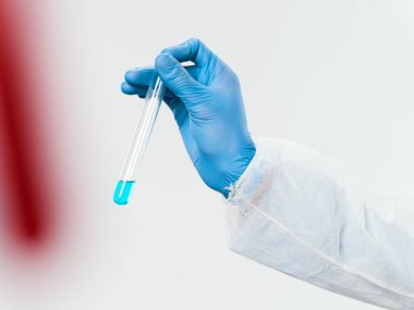 Coronavirus araştırmaları için laboratuvar teşhislerini analiz eder