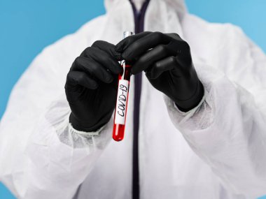 Siyah koruyucu eldivenler laboratuvar kan testi covid-19 araştırma mavi arka plan