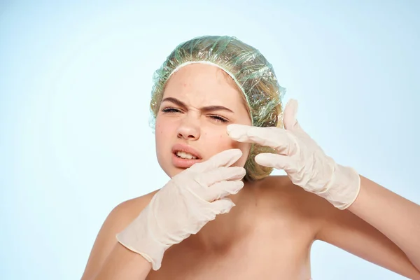 Жінка з голими плечима стискає прищі на обличчі дерматологія — стокове фото